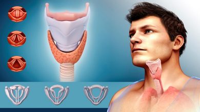 6 أعراض مسببة لمرض شلل الحبال الصوتية.. تعرف على الأسباب والأعراض