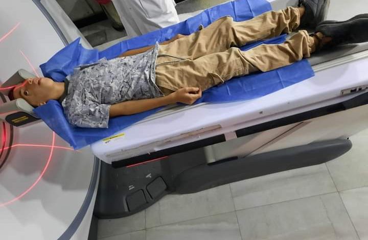 والدة طفل مصاب بمتلازمة تريتشر كولينز تطلب مساعدة لبناء وجهه من جديد