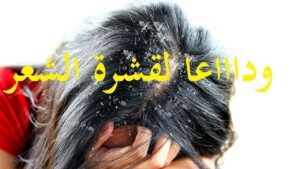 طرق التخلص من القشرة قبل الشتاء